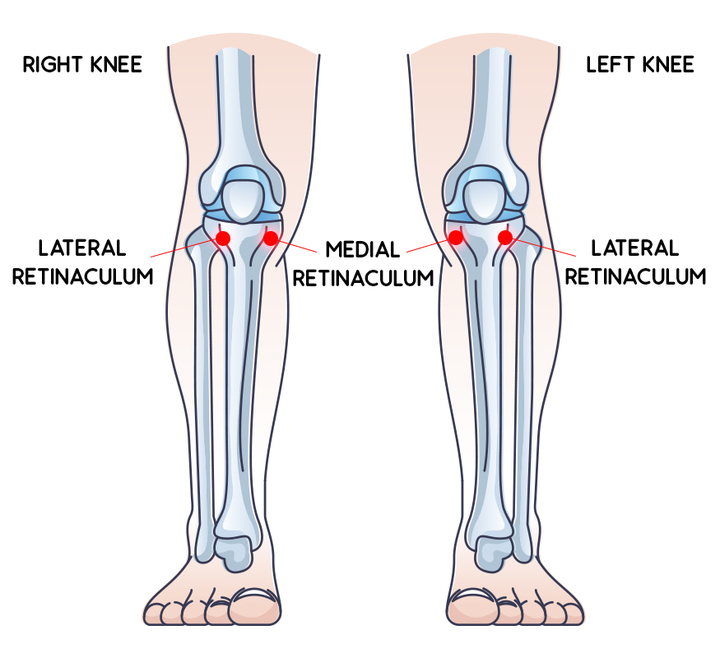 The Medial and Lateral