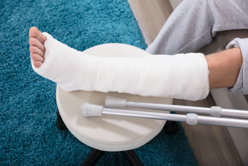 Don't let your cast be an inconvenience! Don't let your cast be an inconvenience!