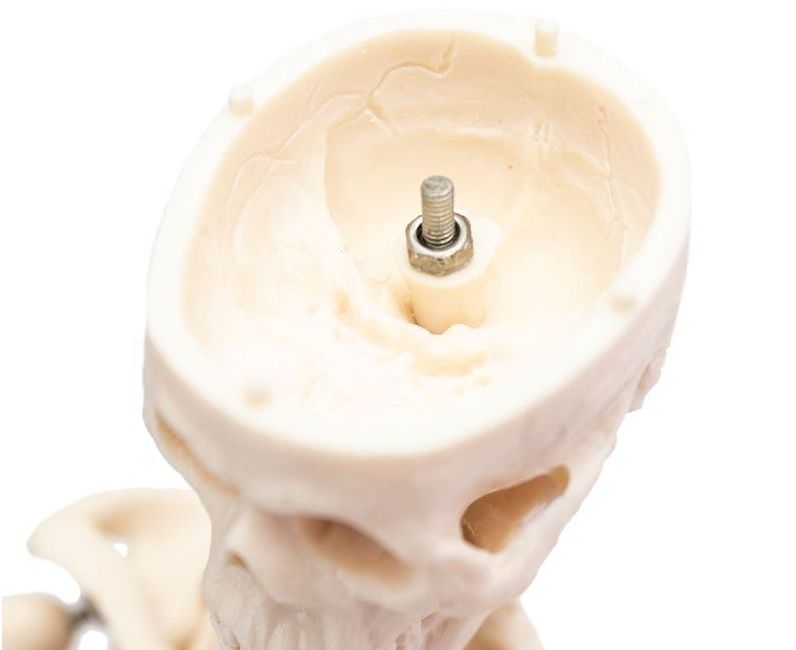 The Desktop Mini's skullcap can be removed The Desktop Mini's Skullcap Can be Removed
