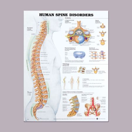 Human Spine Disorders Chart