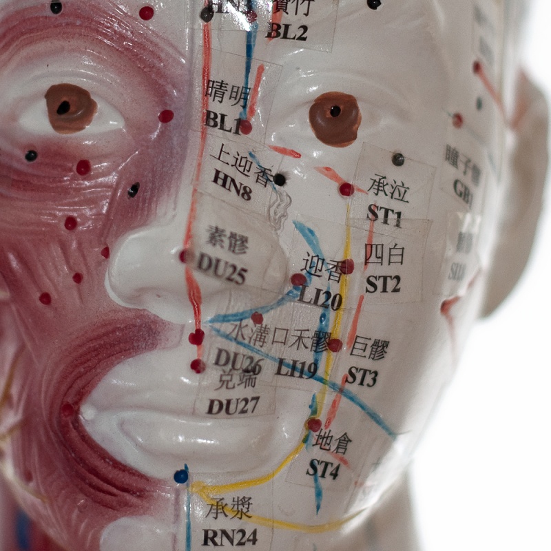 TwoSided Acupuncture Model with Muscles Health and Care