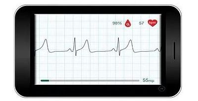 WIWE ECG Monitor