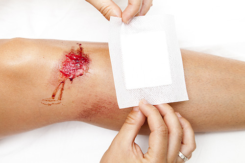 Wound Care