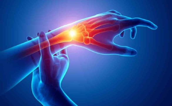 Carpal Tunnel Wrist Pain Arthritis Image