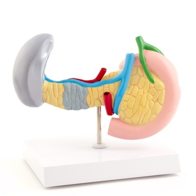 Lifesize Human Pancreas, Spleen, and Gallbladder with Diseases Model