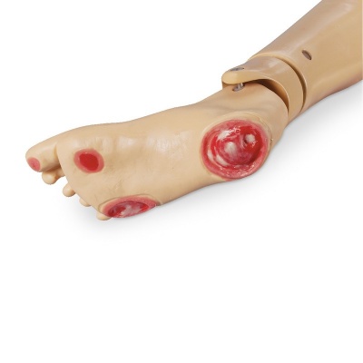 Optional Pressure Ulcer Foot for Geri and KERI Patient Care Manikins
