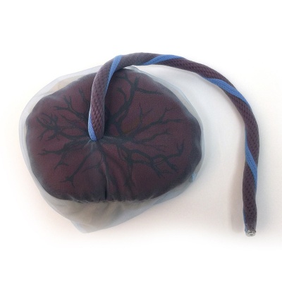 Placenta and Umbilical Cord Model