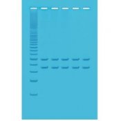 Mitochondrial Dna Analysis Using Pcr