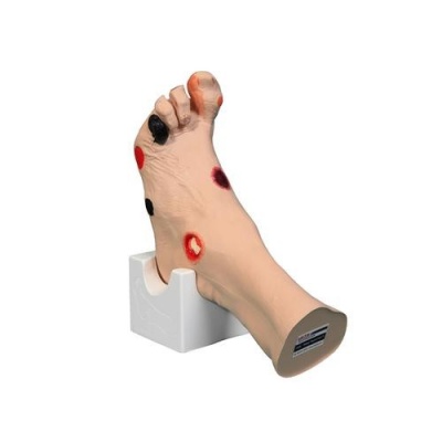 Wilma Wound Foot Medical Training Model